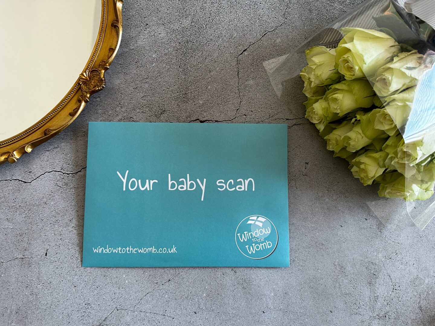 Window to the womb - 4D scan and fetal well being scan review - Vanity Owl