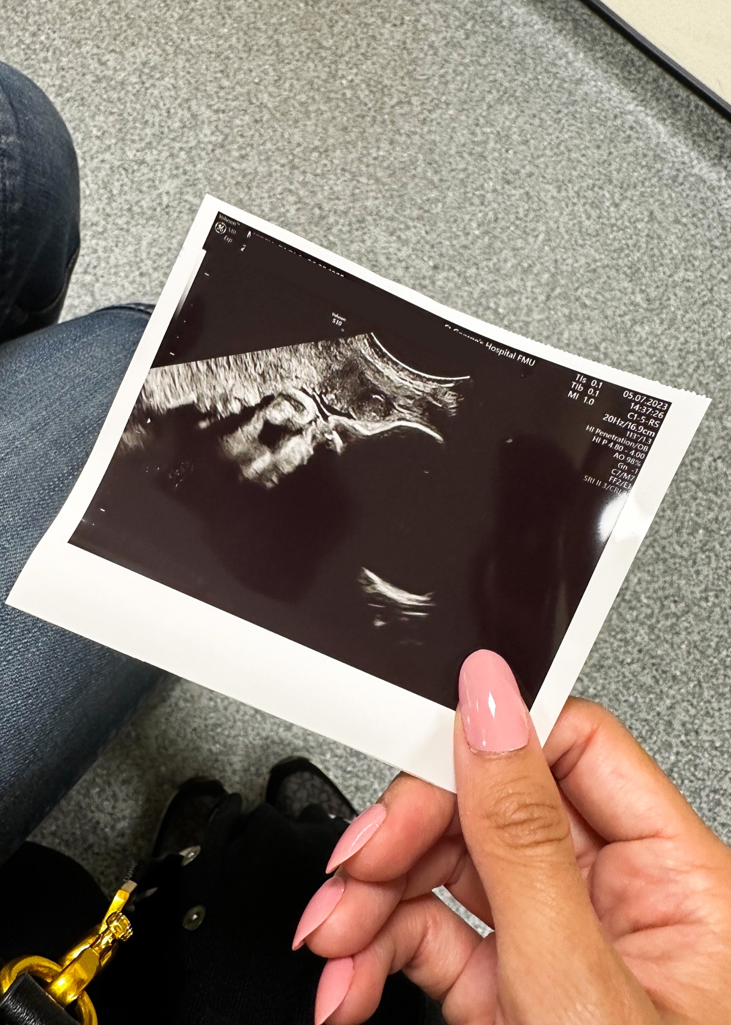 What to expect at your 36 week growth scan appointment - Vanity Owl